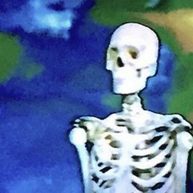 Artwork for Bones - Unrendered